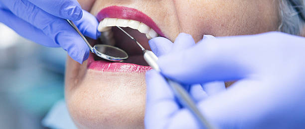 Best Emergency Treatment for Dental Infections or Abscesses in Duncanville, TX